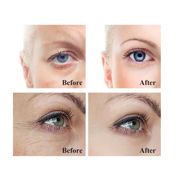অ্যান্টি-এজিং জন্য সৌন্দর্য চোখ ক্রিম wrinkles অপসারণ এবং টান দৃঢ়ীকরণ OEM / ODM গ্রহণযোগ্য 9